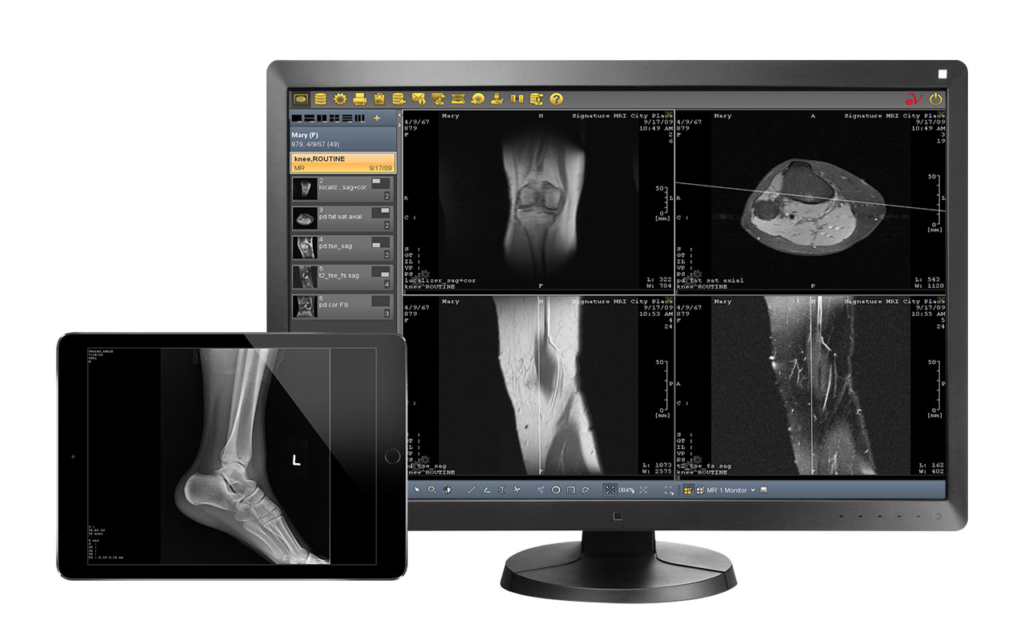 PACS system Radiology