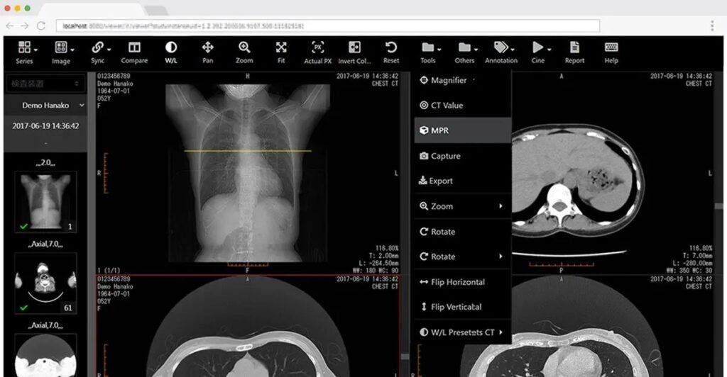 DICOM file viewer