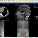 DICOM file viewer