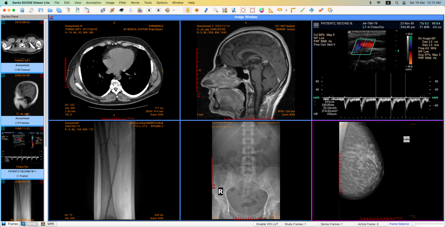 DICOM file viewer