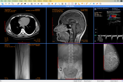 DICOM file viewer