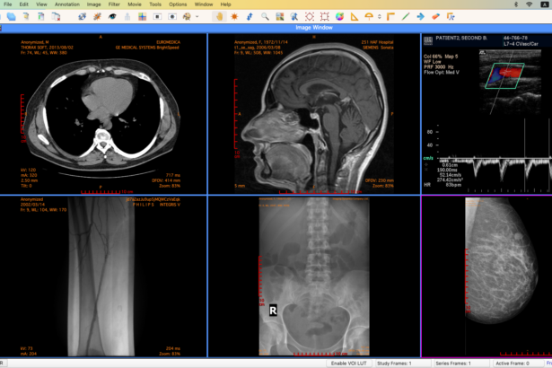 DICOM file viewer