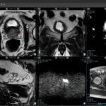 medical imaging software