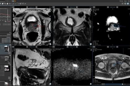 medical imaging software