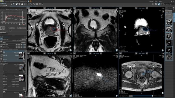 medical imaging software